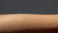 Neurobiologický fenomén: proč se objevuje husí kůže?